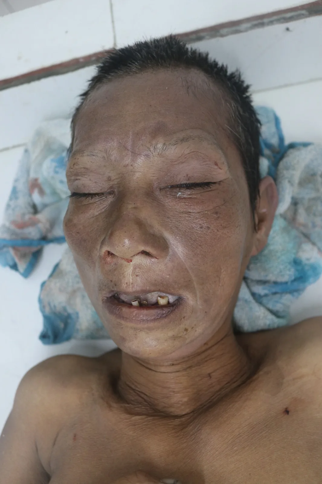 Wanita Korban Tabrak Lari di Dolok Kahean, Jenazah Masih di RS Djasamen Saragih,Sat Lantas Simalungun Minta Warga Agar Mengenali